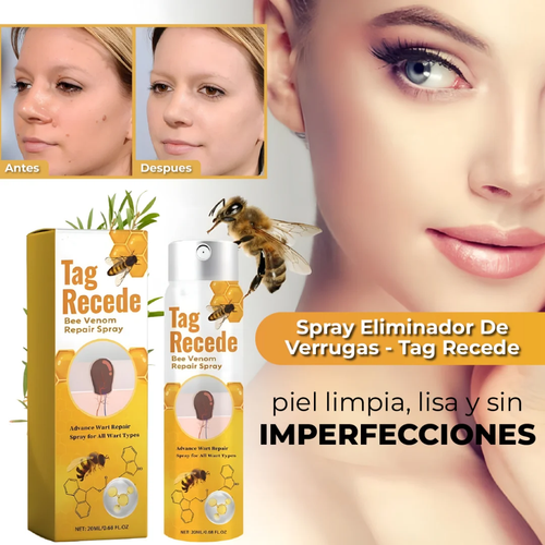 OFERTA 2X1 SPRAY ELIMINADOR DE VERRUGAS - TAG RECEDE